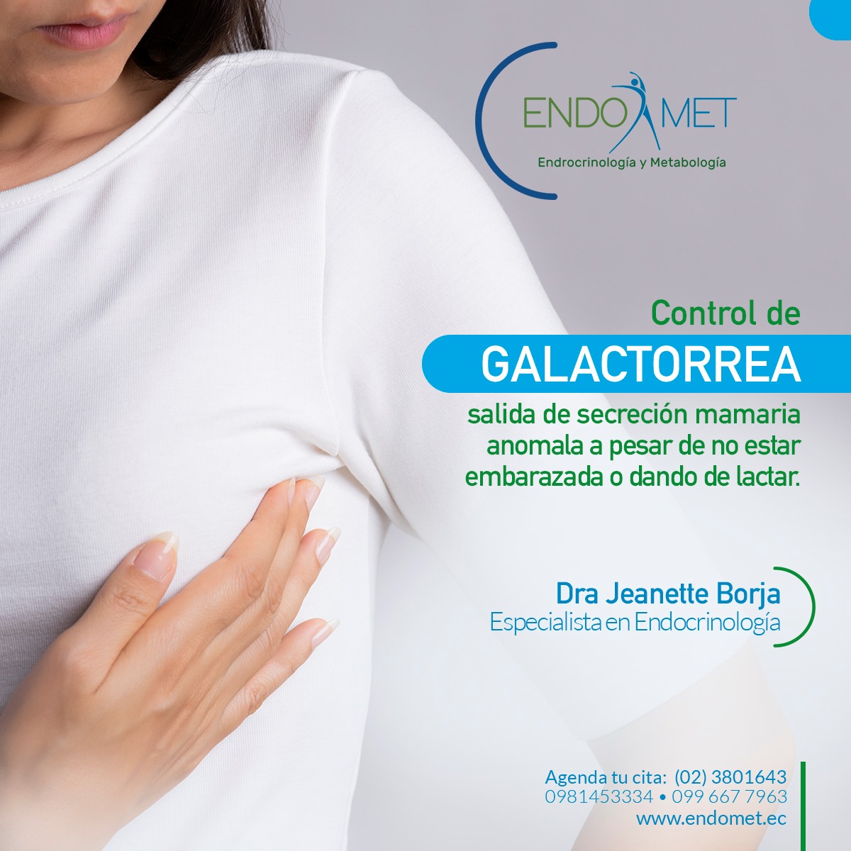 Galactorrea